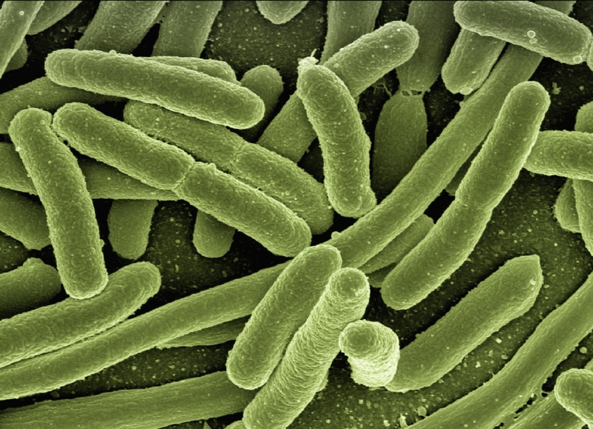 Bild:pixabay.com/de/photos/koli-bakterien-escherichia-coli-123081...